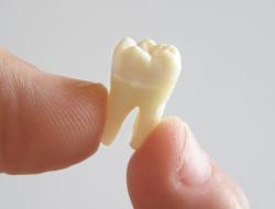 Что делать если выпал зуб у взрослого человека