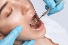 Лечение зубов системой Icon без препарирования